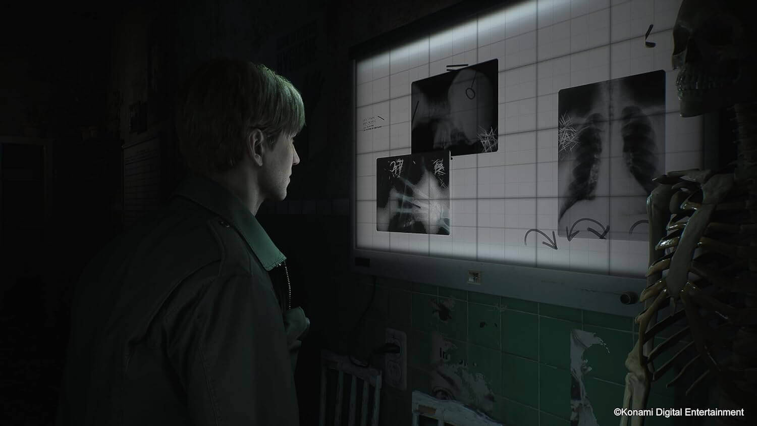 Silent Hill 2 - PS5 – image 8